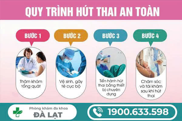 Hình ảnh minh họa